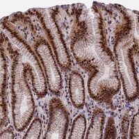 Anti-ZNF707 antibody produced in rabbit 