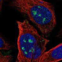 Anti-ZNF71 antibody produced in rabbit 