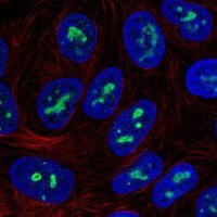 Anti-ZNF713 antibody produced in rabbit 