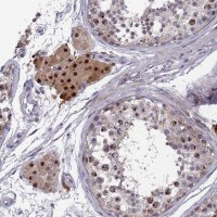 Anti-ZNF717 antibody produced in rabbit 