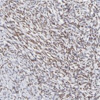 Anti-ZNF74 antibody produced in rabbit 