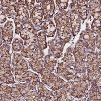 Anti-ZNF749 antibody produced in rabbit