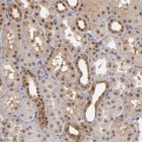 Anti-ZNF75A antibody produced in rabbit 