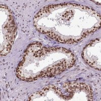 Anti-ZNF75D antibody produced in rabbit 