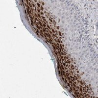 Anti-ZNF76 antibody produced in rabbit 