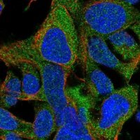 Anti-ZNF764 antibody produced in rabbit 