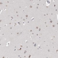 Anti-ZNF770 antibody produced in rabbit 