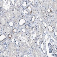 Anti-ZNF772 antibody produced in rabbit 