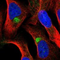 Anti-ZNF774 antibody produced in rabbit 