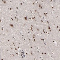 Anti-ZNF777 antibody produced in rabbit 