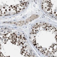 Anti-ZNF783 antibody produced in rabbit 