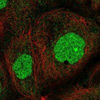 Anti-ZNF791 antibody produced in rabbit 