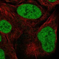 Anti-ZNF792 antibody produced in rabbit 