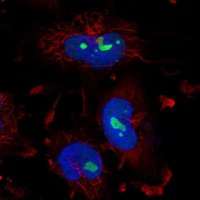 Anti-ZNF800 antibody produced in rabbit HPA052194-100UL