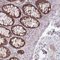 Anti-ZNF81 antibody produced in rabbit 