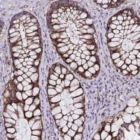 Anti-ZNF813 antibody produced in rabbit 