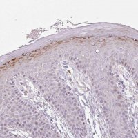 Anti-ZNF814 antibody produced in rabbit 