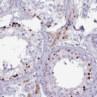 Anti-ZNF816-ZNF321P antibody produced in rabbit 