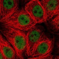 Anti-ZNF821 antibody produced in rabbit 