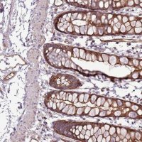 Anti-ZNF827 antibody produced in rabbit 