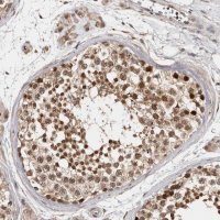 Anti-ZNF83 antibody produced in rabbit 