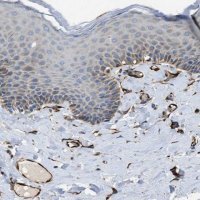 Anti-ZNF831 antibody produced in rabbit 