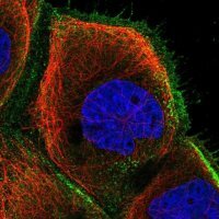Anti-ZNF839 antibody produced in rabbit 