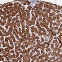 Anti-ZNF844 antibody produced in rabbit 