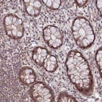 Anti-ZNF85 antibody produced in rabbit 