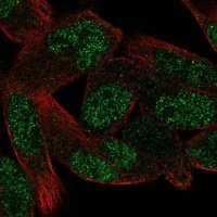 Anti-ZNF850 antibody produced in rabbit