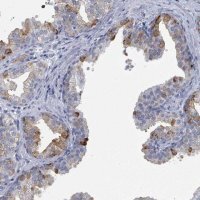 Anti-ZNF852 antibody produced in rabbit 