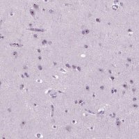 Anti-ZNF853 antibody produced in rabbit 