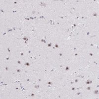 Anti-ZNF860 antibody produced in rabbit 