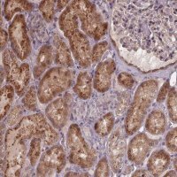 Anti-ZNF879 antibody produced in rabbit 
