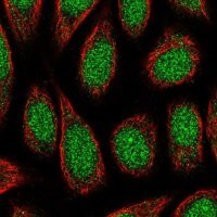 Anti-ZNF879 antibody produced in rabbit 