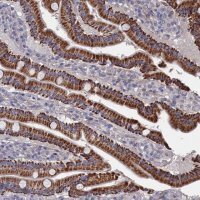 Anti-ZNF891 antibody produced in rabbit 