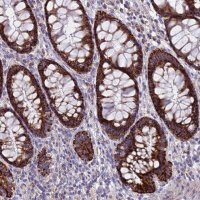 Anti-ZNFX1 antibody produced in rabbit 