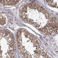 Anti-ZNRF2 antibody produced in rabbit 