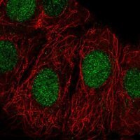 Anti-ZRANB3 antibody produced in rabbit 