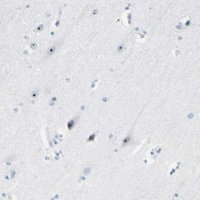 Anti-ZSCAN1 antibody produced in rabbit 