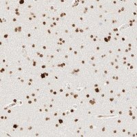Anti-ZSCAN18 antibody produced in rabbit 