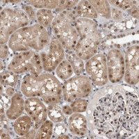 Anti-ZSCAN21 antibody produced in rabbit 