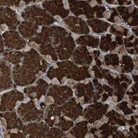 Anti-ZSCAN22 antibody produced in rabbit 
