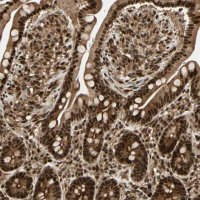 Anti-ZSCAN30 antibody produced in rabbit 