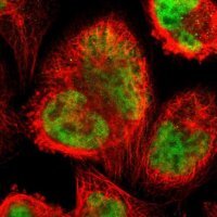 Anti-ZSCAN31 antibody produced in rabbit 
