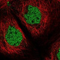 Anti-ZSCAN32 antibody produced in rabbit