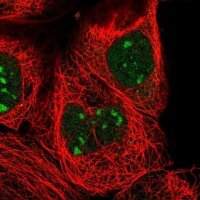 Anti-ZXDC antibody produced in rabbit 