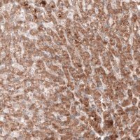 Monoclonal Anti--G6PC antibody produced in mouse 