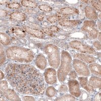 Monoclonal Anti--G6PC antibody produced in mouse 