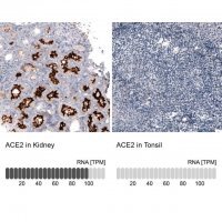 Monoclonal Anti-ACE2 antibody produced in mouse 